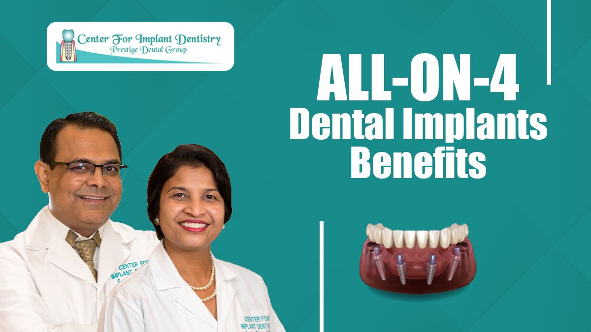 All-On-4 Dental Implants Benefits